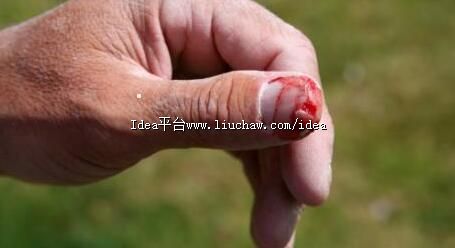 手扎刺不挑出来会有怎样的后果 巧挑肉中刺的小窍门