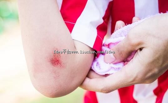 �ճ�����С�˿ڵ���ȷ���� ��ѧ�����˿ڵ�ԭ��